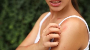 signs that you have parasites in your body