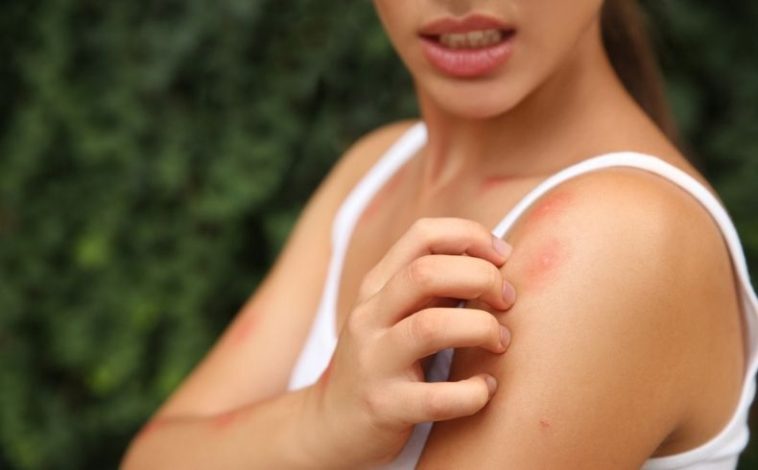 signs that you have parasites in your body